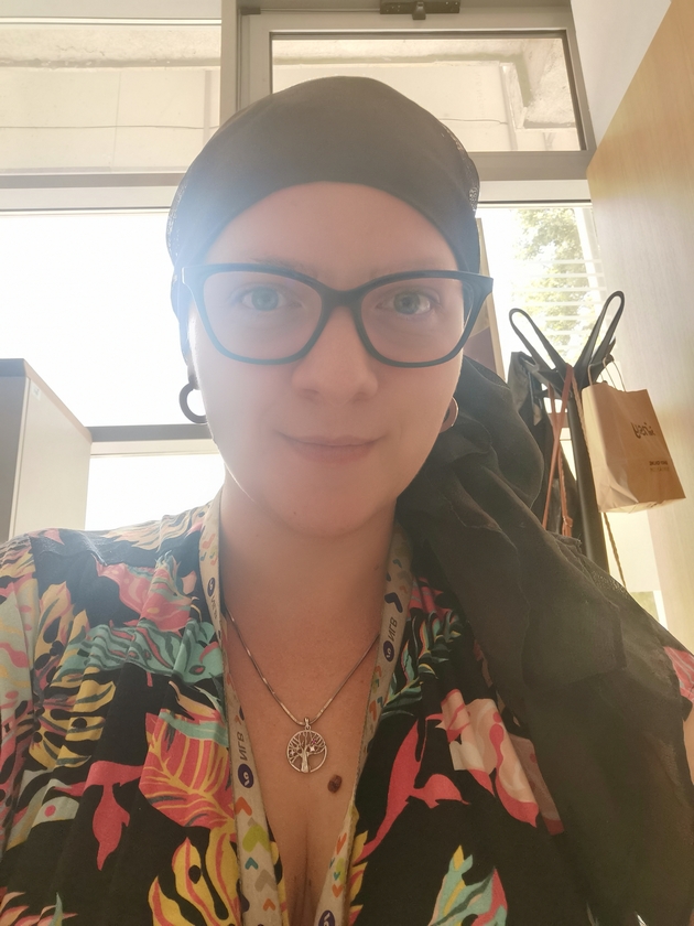 kristina-andova-za-bitkata-so-alopecija-nikogash-nema-da-nosam-marami-sega-koga-ja-znam-slobodata-bez-niv-09.JPG