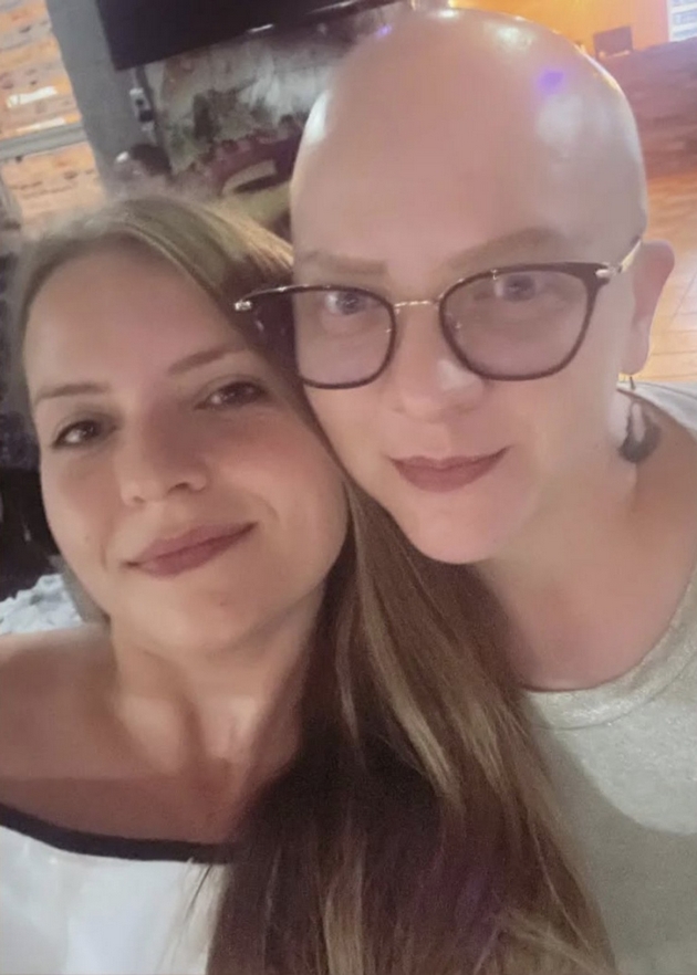 kristina-andova-za-bitkata-so-alopecija-nikogash-nema-da-nosam-marami-sega-koga-ja-znam-slobodata-bez-niv-12.JPG