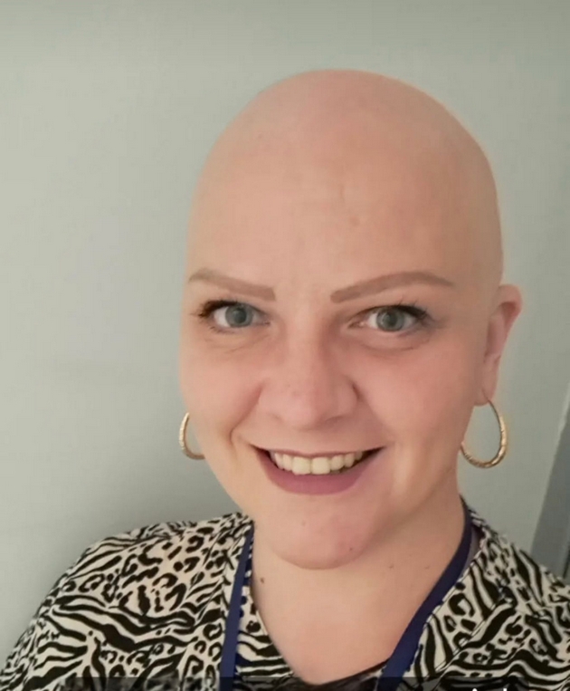 kristina-andova-za-bitkata-so-alopecija-nikogash-nema-da-nosam-marami-sega-koga-ja-znam-slobodata-bez-niv-13.JPG
