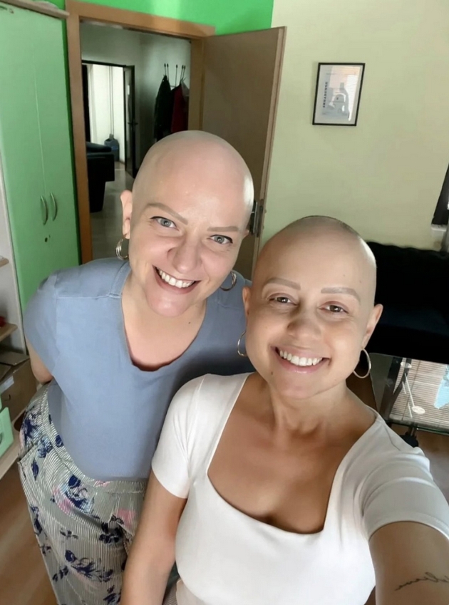 kristina-andova-za-bitkata-so-alopecija-nikogash-nema-da-nosam-marami-sega-koga-ja-znam-slobodata-bez-niv-14.JPG