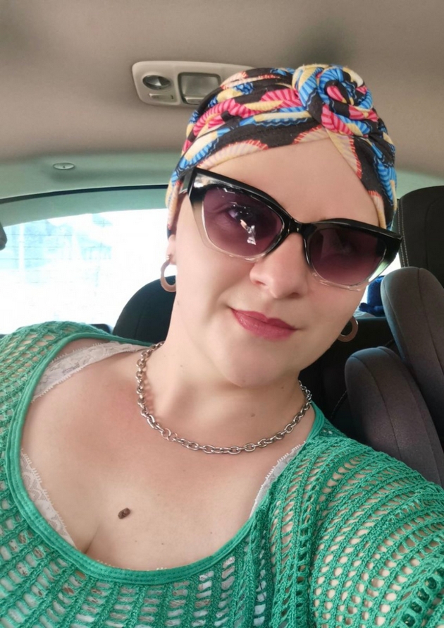 kristina-andova-za-bitkata-so-alopecija-nikogash-nema-da-nosam-marami-sega-koga-ja-znam-slobodata-bez-niv-15.JPG