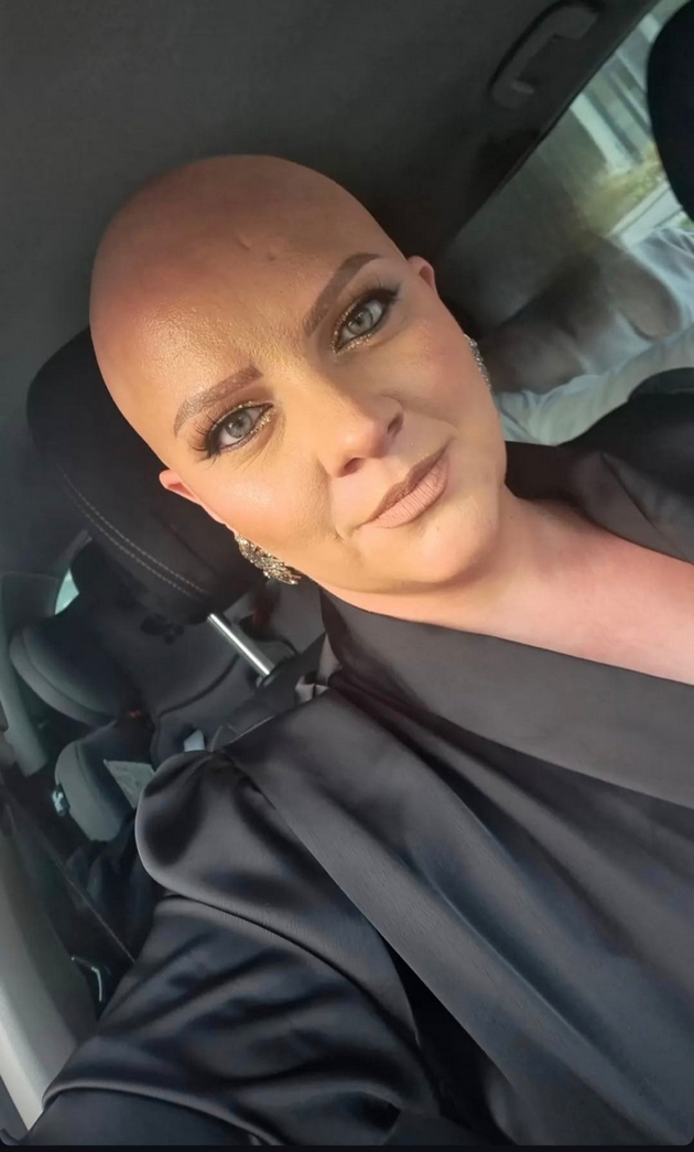 kristina-andova-za-bitkata-so-alopecija-nikogash-nema-da-nosam-marami-sega-koga-ja-znam-slobodata-bez-niv-18.JPG