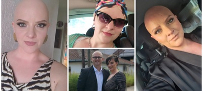 kristina-andova-za-bitkata-so-alopecija-nikogash-nema-da-nosam-marami-sega-koga-ja-znam-slobodata-bez-niv-povekje.jpg
