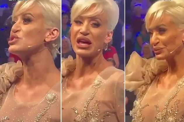 sedumpati-go-operirashe-nosot-a-rezultatot-e-uzhasen-srpska-voditelka-ismeana-po-poslednata-korekcija-02.jpg