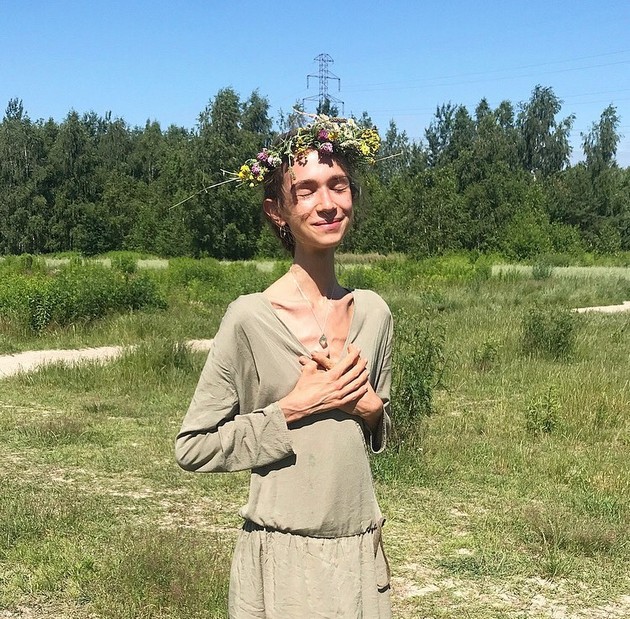 jadela-samo-ovoshje-imala-22kg-tazhnata-prikazna-na-devojka-shto-pochina-od-neishranetost-na-bali-03.jpg