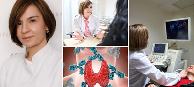 d-r-biljana-crcareva-tiroidolog-hashimoto-e-epidemija-na-21-vek-naglo-slabeenje-ili-debeleenje-chesto-ukazhuvaat-na-problemi-so-tiroideata-poveke-01.jpg