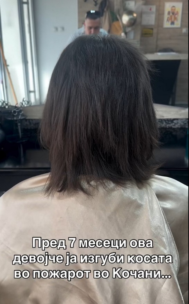 tamara-od-kochani-koja-ja-izgubi-kosata-vo-pozharot-vo-kochani-koga-se-vrativ-od-bolnica-izgledot-mi-beshe-promenet-no-se-prifativ-02.jpg