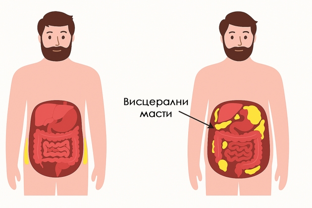 kolku-se-opasni-masnite-naslagi-na-stomakot-i-koga-da-odite-na-lekar-5.jpg