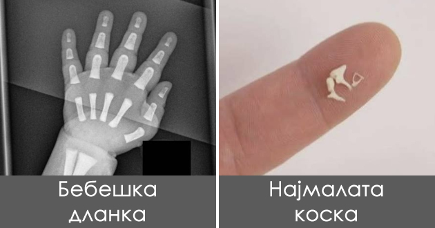 dehidrirana-krv-vishok-zabi-fotki-koi-pokazhuvaat-kolku-e-chudno-chovechkoto-telo-01.jpg