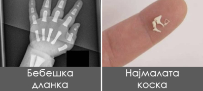 dehidrirana-krv-vishok-zabi-fotki-koi-pokazhuvaat-kolku-e-chudno-chovechkoto-telo-povekje.jpg