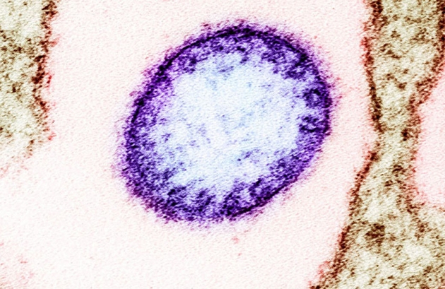 nema-lek-ili-vakcina-se-prenesuva-od-liljaci-shto-znaeme-za-smrtonosniot-virus-nipah-koj-se-pojavi-vo-indija-02.JPG