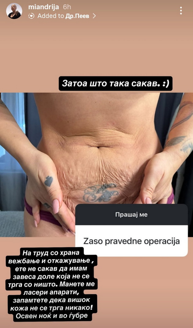mia-kostova-napravi-liposukcija-na-stomakot-bev-budna-vo-tekot-na-operacijata-me-chineshe-okolu-1500-09.jpg