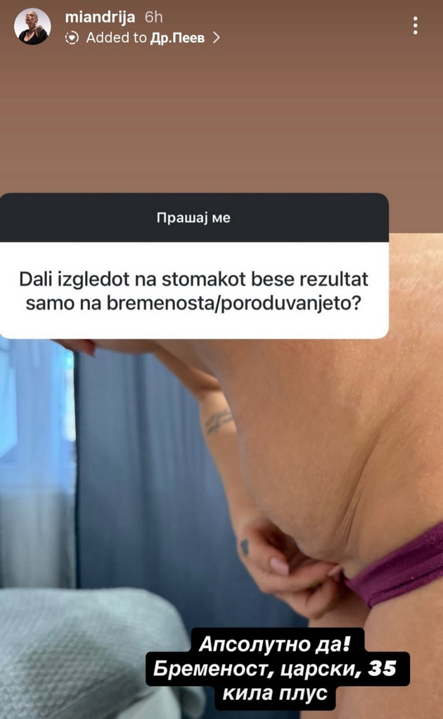 mia-kostova-napravi-liposukcija-na-stomakot-bev-budna-vo-tekot-na-operacijata-me-chineshe-okolu-1500-11.jpg