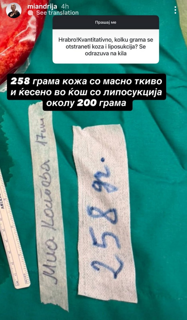 mia-kostova-napravi-liposukcija-na-stomakot-bev-budna-vo-tekot-na-operacijata-me-chineshe-okolu-1500-20.jpg