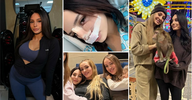 sestrata-na-luna-djogani-si-napravi-operacija-na-nosot-so-kadri-direktno-od-bolnica-01.jpg