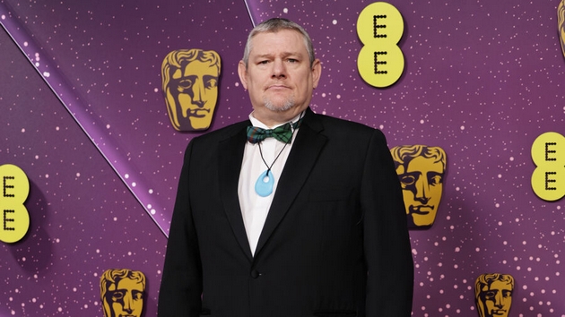 kako-izgleda-zhivotot-so-turetov-sindrom-ja-opcu-kralica-elizabeta-vo-lice-kazha-rasistichka-navreda-na-bafta-03.JPG