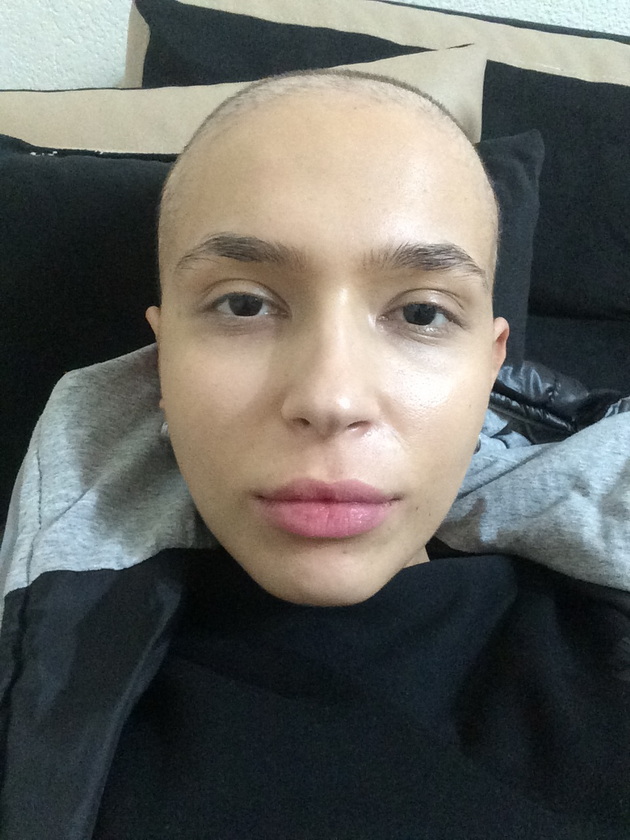 angela-doncheva-na-22-godini-mi-dijagnosticiraa-leukemija-imav-transplantacija-vo-germanija-raskrstiv-so-stravot-20.jpeg