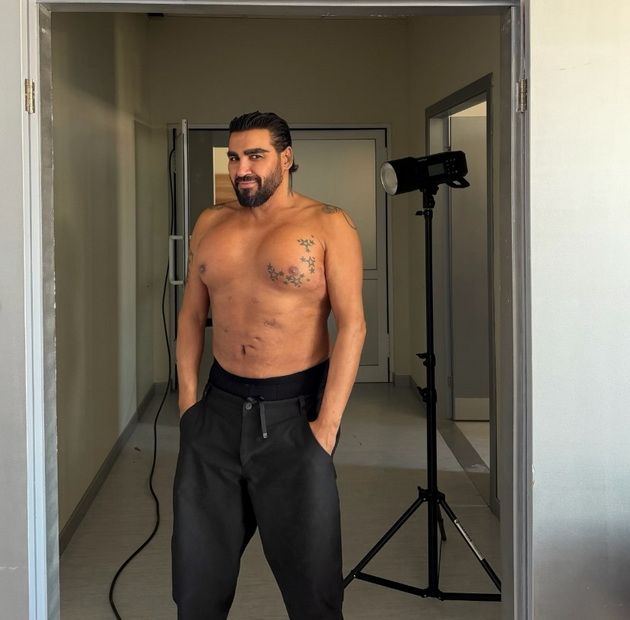 azis-gi-pokazha-gradite-so-implanti-po-operacijata-ako-ti-mozhesh-da-nosish-fejk-patiki-zoshto-jas-da-ne-mozham-gradi-04.jpg