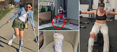 srbinka-so-video-shto-ezhi-pokazhuva-kako-ja-skrshila-nogata-bez-da-padne-sega-so-gips-vezhba-vo-teretana-01povekje.jpg