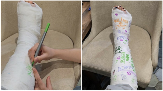 srbinka-so-video-shto-ezhi-pokazhuva-kako-ja-skrshila-nogata-bez-da-padne-sega-so-gips-vezhba-vo-teretana-04.jpg