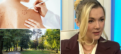 d-r-andjelka-ilieva-chovek-si-go-shetashe-kucheto-vo-gradski-park-skopje-mu-vidovme-chudna-benka-i-mu-otkrivme-melanom-01povekje.jpg
