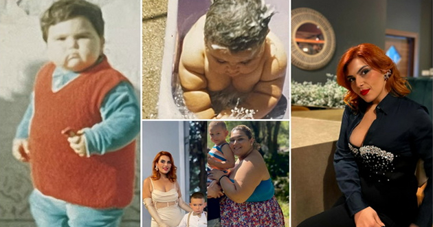 gabriela-jancheska-imala-20kg-na-edna-godina-a-131kg-na-23-bubregot-od-levata-strana-mi-beshe-otkachen-od-saloto-01.jpg
