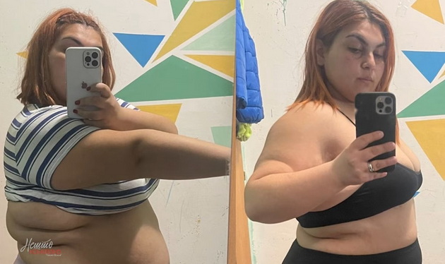 gabriela-jancheska-imala-20kg-na-edna-godina-a-131kg-na-23-bubregot-od-levata-strana-mi-beshe-otkachen-od-saloto-14.jpg