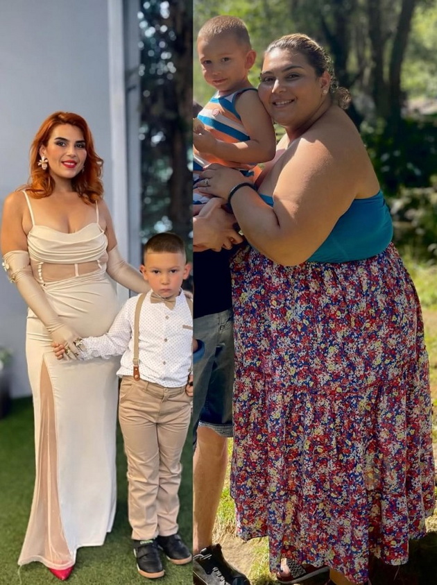 gabriela-jancheska-imala-20kg-na-edna-godina-a-131kg-na-23-bubregot-od-levata-strana-mi-beshe-otkachen-od-saloto-18.jpg