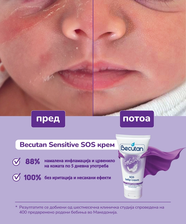 becutan-sensitiv-za-najchustvitelnata-bebeshka-kozha-vnimatelno-izbrani-sostojki-za-intenzivna-nega-i-zashtita-01.JPG