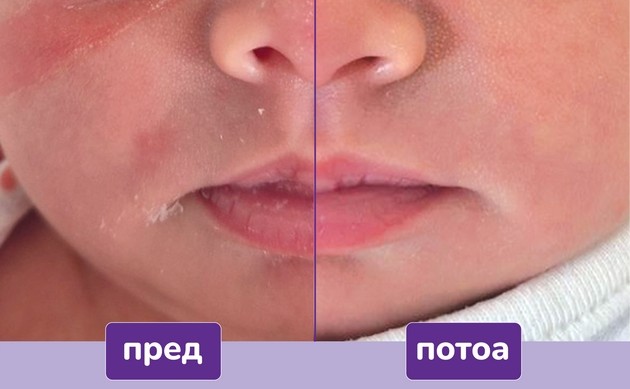 becutan-sensitiv-za-najchustvitelnata-bebeshka-kozha-vnimatelno-izbrani-sostojki-za-intenzivna-nega-i-zashtita-01_copy.JPG