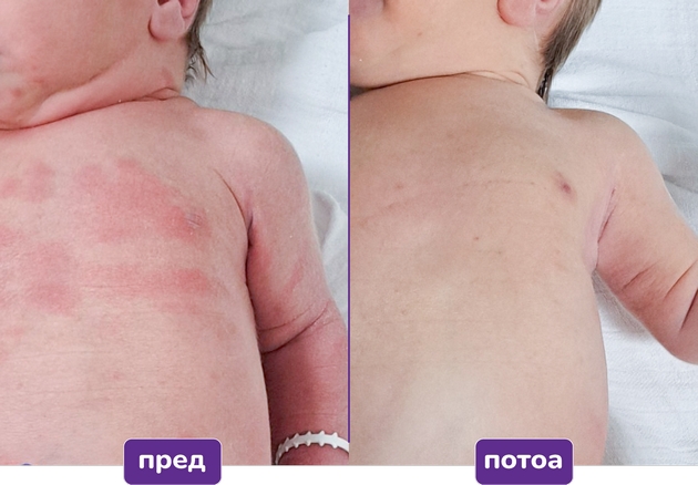 becutan-sensitiv-za-najchustvitelnata-bebeshka-kozha-vnimatelno-izbrani-sostojki-za-intenzivna-nega-i-zashtita-02.JPG