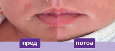 becutan-sensitiv-za-najchustvitelnata-bebeshka-kozha-vnimatelno-izbrani-sostojki-za-intenzivna-nega-i-zashtita-povekje.jpg