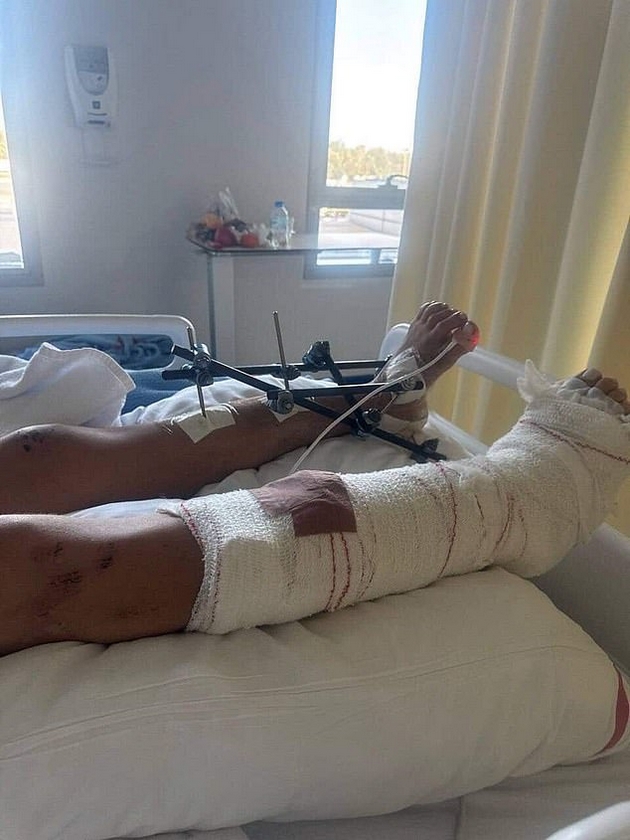 se-oglasi-devojkata-koja-beshe-najdena-so-skrsheni-race-i-noze-vo-dubai-me-napadnaa-bogatashi-mi-se-zakanuvaat-i-sega-a-policijata-gi-shtiti-04.JPG