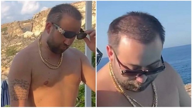 rasta-e-neprepoznatliv-na-odmor-na-malta-so-drugarite-gi-potstrizhal-sukanicite-opushten-stomak-03.jpg