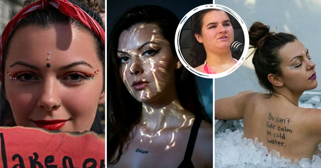 betika-za-jovana-devojka-so-oshteten-vid-od-resen-taa-se-soochi-so-mnogu-navredi-i-tortura-no-dushata-i-e-pogolema-od-celiot-grad-01.jpg