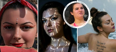 betika-za-jovana-devojka-so-oshteten-vid-od-resen-taa-se-soochi-so-mnogu-navredi-i-tortura-no-dushata-i-e-pogolema-od-celiot-grad-01povekje.jpg