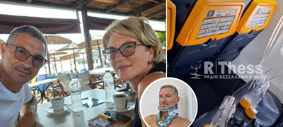 prva-fotografija-i-izjava-na-srbinot-povreden-vo-avionot-na-ryanair-se-sekjavam-na-eksplozijata-go-slusham-zvukot-shtom-zatvoram-ochi-poveke-01.jpg