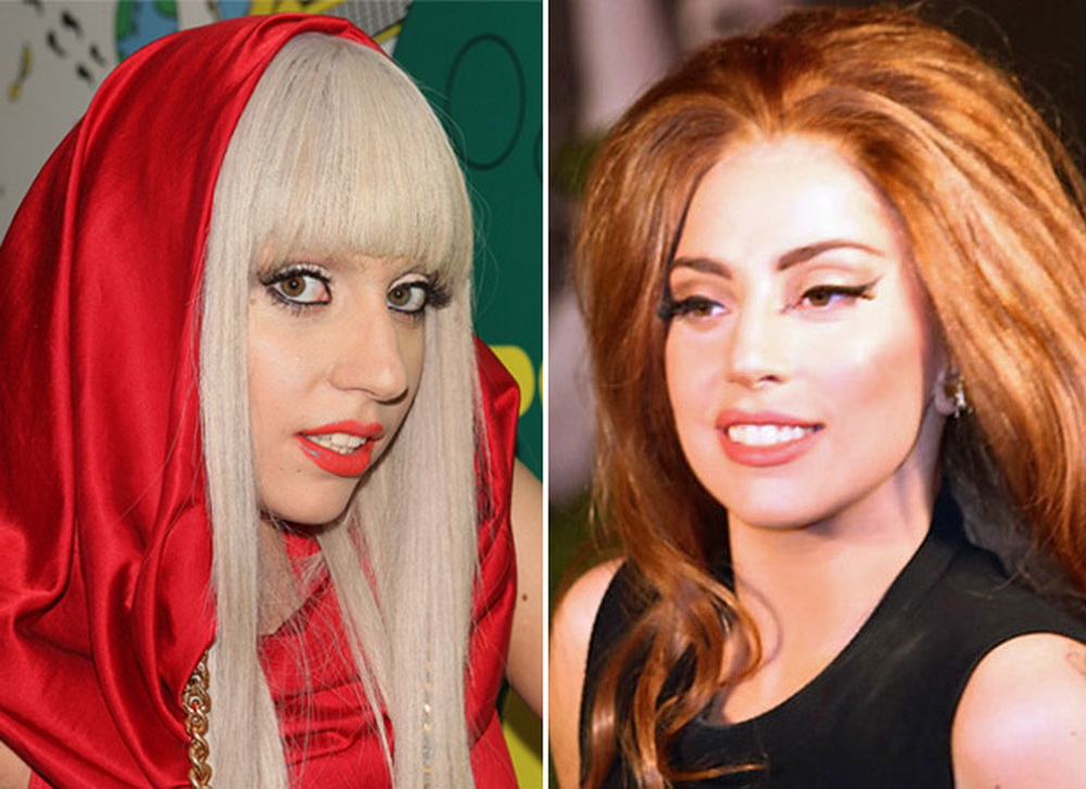 Lady gaga before plastic surgery - 🧡 Does Lady Gaga Have Plastic Surgery? 