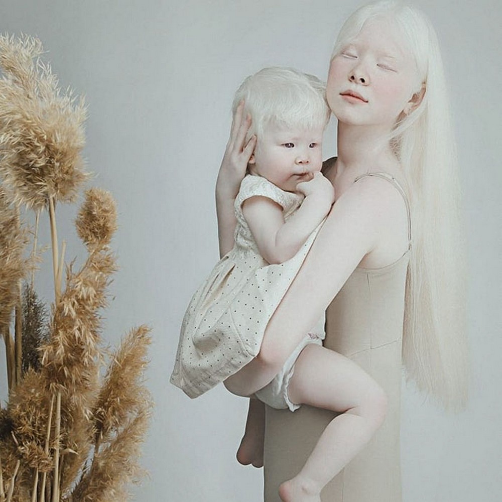 Как люди рождаются альбиносами. Сестры альбиносы из Казахстана.