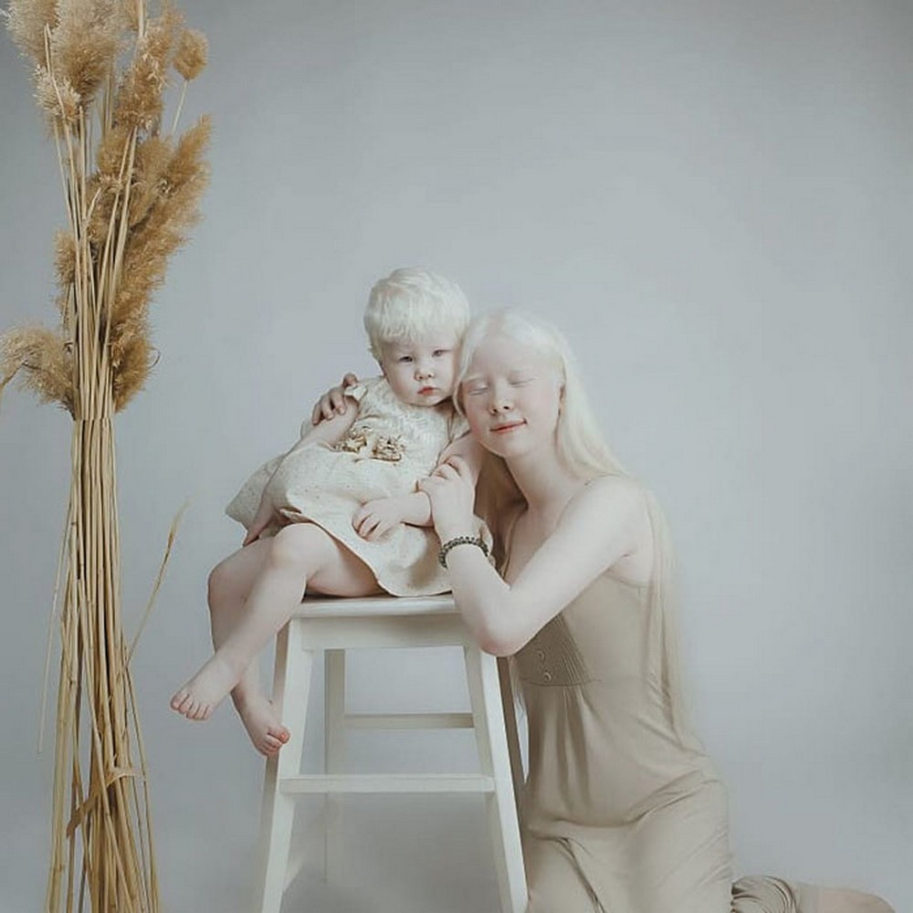 Как люди рождаются альбиносами. Сестры альбиносы из Казахстана. 4 Сестры альбиносы.