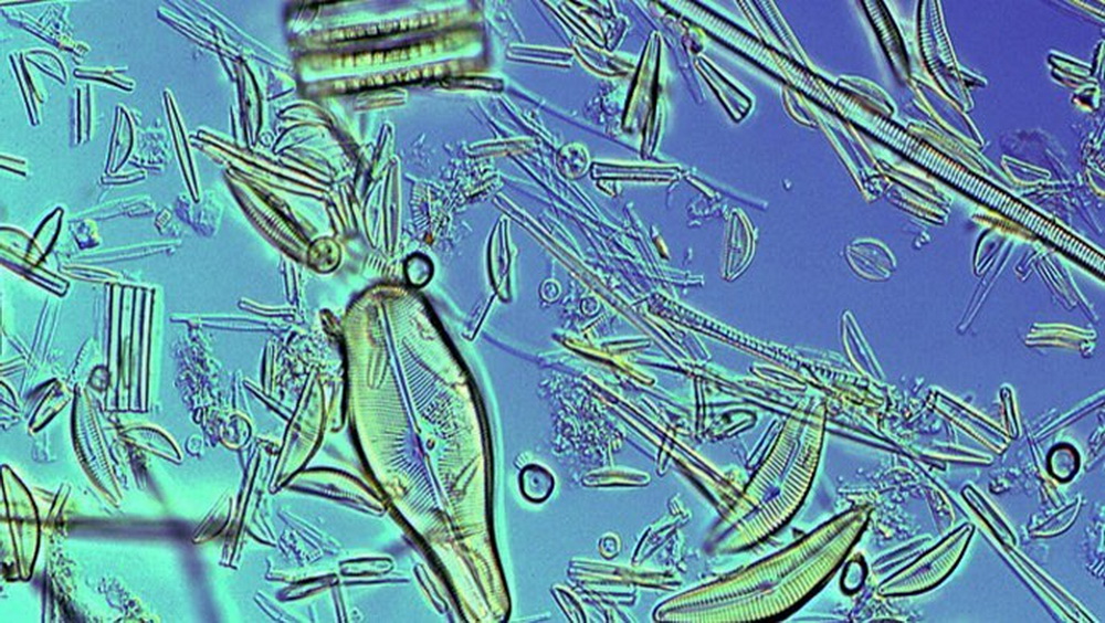 Бактерии в соленой воде. Микроорганизмы в воде под микроскопом. Бактерии в воде под микроскопом. Микробы в воде под микроскопом. Микроорганизмы в микроскопе.
