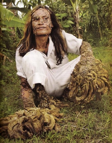 tree-man